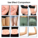 Tingmay 360 Fat Freeze Machine for Body Slimming - Image 7