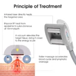 www.hktmay.com_cryolipolyis_TM-922D_Tingmay Criolipolisis Machine_Cellulite Massage Vacuum RF Roller