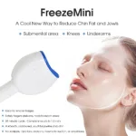 Tingmay Professional Freezing Fat Body Contouring Machine - Image 6