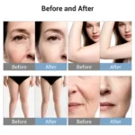 www.hktmay.com_cavitation machine_TM-660D Tingmay Radio Frequency Cavitation Fat Burning Machine_Before and After