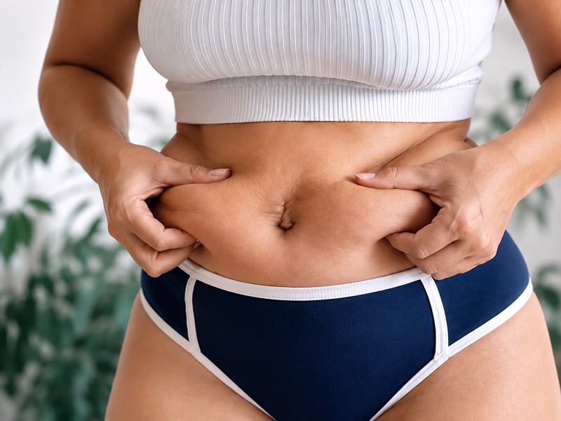 velofrost blog 360 cryolipolysis machine salon 02