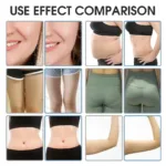 Velofrost Vertical 360 Cryolipolysis Machine For Fat Freezing – Bild 7