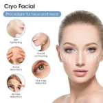Velofrost Cryoskin Body Slimming Face Lifting Machine – Image 6